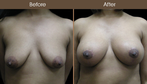 20202805172405_B102-Front